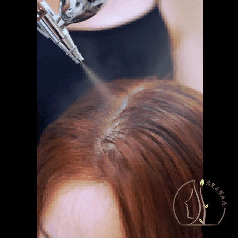 最後補充毛囊營養，穩定頭皮狀態，並再次檢測改善度，清楚看到你的頭皮變化與亮度。